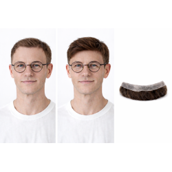 Prothèse capillaire frontale | Boutique de la Perruque