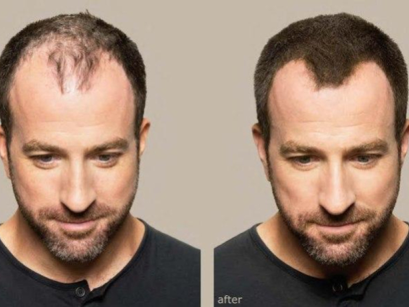 Poudres capillaires : masquer la chute de cheveux instantanément